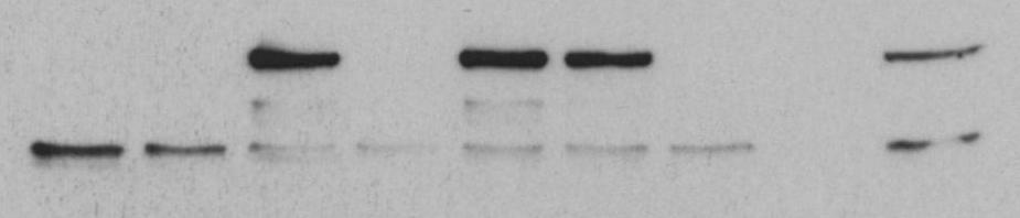 K2 Transf. Reag. x Detection: Akt1 Akt1-EGFP Akt1 Akt1-EGFP Detection: GFP EGFP β-actin Plasmid: - 4 µg 4 µg 3.2 µg 3.