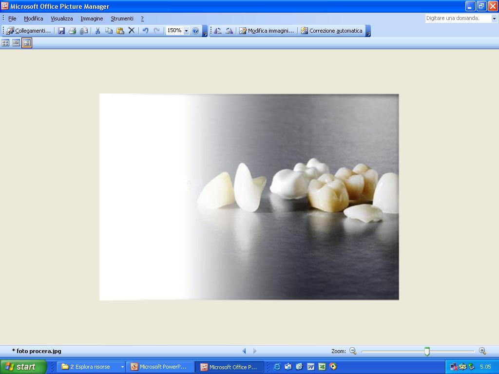 All ceramic crowns from dip moulding