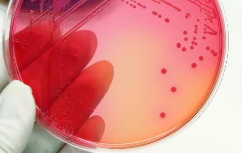 Blood agar is an enriched, bacterial growth medium.