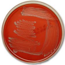 Staphylococcus aureus E.