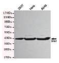 PO LISA Kit Fibronectin antibody GATA3 antibody LISA LISA IC, IC AG80143 AG80229 AG80185 AG54038 G-CSF LISA Kit G-CSF LISA Kit GO beta / CXCL2 LISA Kit ICA-1 antibody LISA LISA