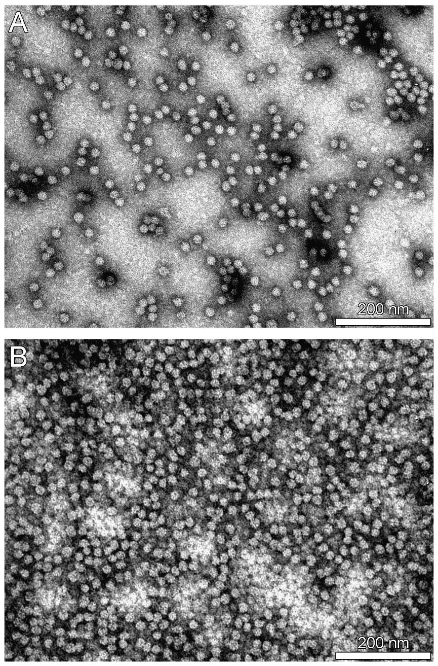 Figure S4. Uranyl acetate-stained TEM micrographs of G-ELP-CCMV after reaction with T4L- LPETG. Scale bars correspond to 200 nm. A) Particles after dialysis to ph 7.