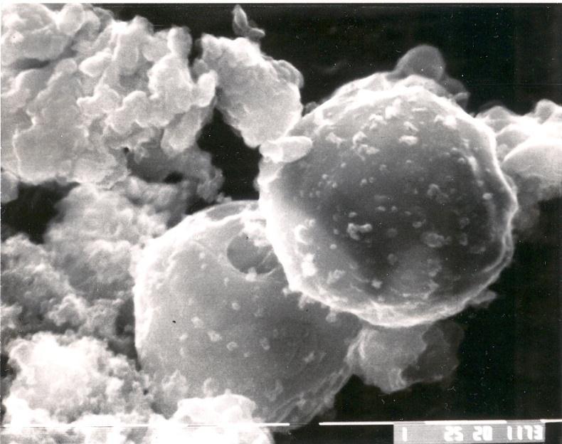 Figure 1-. Micrograph of two.5-micrometer particles collected from ambient air. (Electron Microscopy and Elemental Analysis of Fractionated Atmospheric Particles for Source Identification, William J.
