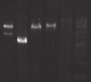 2 μm Antisense Primer (20 μm) 0.5 μl 0.2 μm TaKaRa LA Taq 0.5 μl 2.5 units/50 μl Human genomic DNA (500 ng/μl) 1 μl 500 ng/50 μl Sterile distilled water 34.5 μl total 50 μl PCR conditions : 94 1 min.