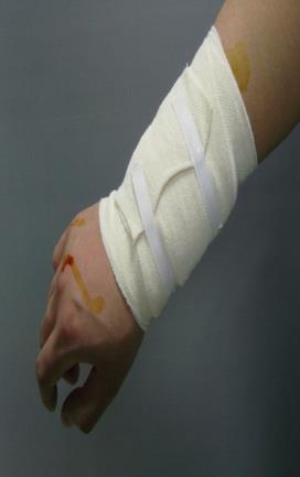 If it does not stop bleeding, wrap the bandage