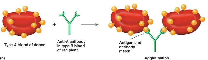 Agglutination Reaction A person with blood type B cannot receive blood from a donor with blood type A.