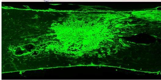Regeneration Rat Acute Spinal Cord
