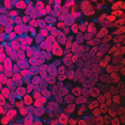 SAMPLE DATA BG01V Human Embryonic Stem Cells Ectoderm Differentiation