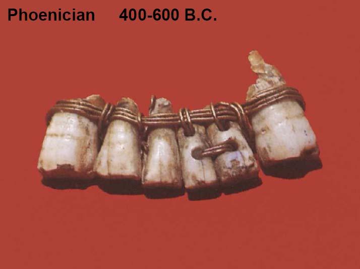 A very short history of biomaterials The Romans,