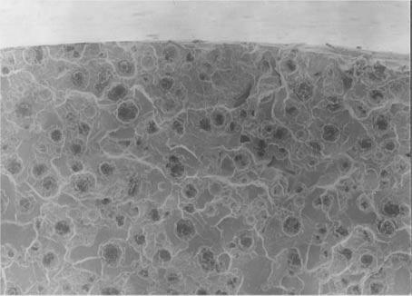 11) The fracture surfaces were observed by SEM. Figure 12 shows the results of the untreated specimen and those of series B.
