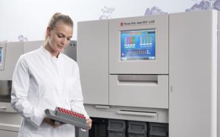 The 15-inch touchscreen with intuitive and optimized Graphic User Interface offers simple operation and monitoring of the automated embedding process.