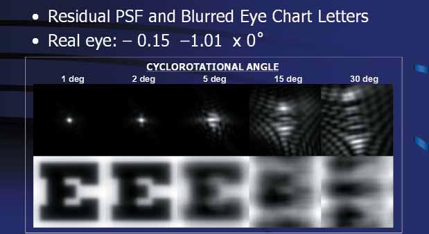 In order to maximize custom ablation outcomes, it is important to position the ablation pattern onto the cornea in a manner that corresponds directly to the measurements taken by the wavefront device.