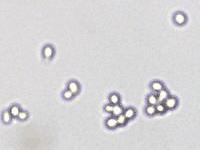 Figure 1(b) shows the yeast cells, imaged with AutoM10, with much more details than those in Figure 1(a).