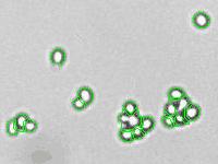 (a) (b) (c) Figure 1. Yeast cells imaged by Cellometer Auto T4 and Auto M10.