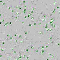 Figure 6. Images of algae cells: (a) raw image; (b) counted cells circled in green.