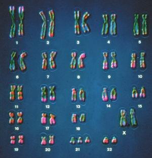 F G n inversion reverses a segment within a chromosome. F G B C D E F G M P Q R translocation moves a segment from one chromosome to a nonhomologous chromosome.