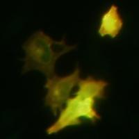 acetylated cellular 4R-tau, and RD4,