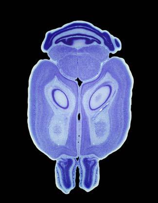 Non-invasive Transcranial Photoacoustic Image of of a Mouse Brain: 3D Imaging PAT image (5 mm deep) Histology (cm) 0.5 1.0 1.5 2.0 0 CB FT HC FL CT OL 0 0.5 1.0 1.5 2.0 (cm) Optics Letters 28, 1739 (2003).