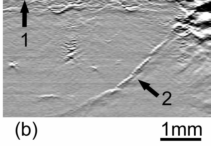 Imaging Depth and Resolution 3 mm Imaging depth: ~3 mm Axial resolution: ~15 microns Depth/resolution: ~200 pixels B-scan of a black double-stranded cotton thread