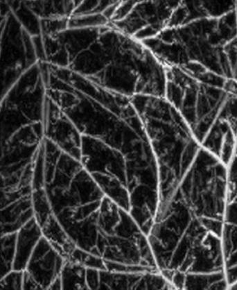 Volumetric Imaging of of Microvasculature In In