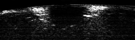 Postmortem imaging at 584-nm optical wavelength.