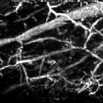 13 mm Skin surface B-scan image 2