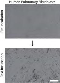 Instructions Fig. 2: After incubation with NanoShuttle TM -PL, cells will appear peppered with the brown nanoparticles, as demonstrated by primary human pulmonary fibroblasts. Scale bar = 100 µm.