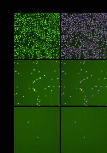 Example AO/PI fluorescent images, and counted images at different Jurkat cell concentrations