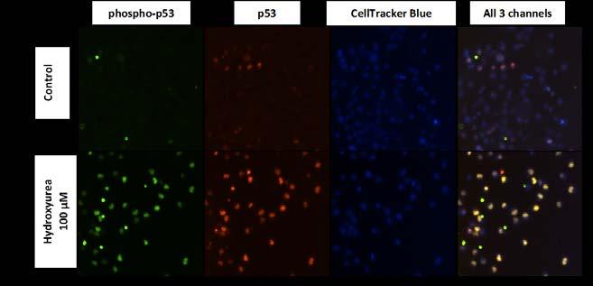 Assay Name: p53 and phospho-p53 fluorescent marker analysis Assay ID: Celigo_02_0009 Description: Quantification of p53 and phospho-p53 levels in NCI-H460 cells post Hydroxyurea treatment Stains:
