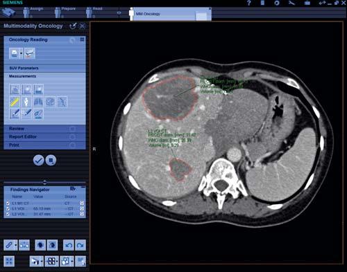 are discovered in CT, MRI or PET: Everybody involved in early detection, diagnostics and the treatment of cancer can retrieve the most complete information.