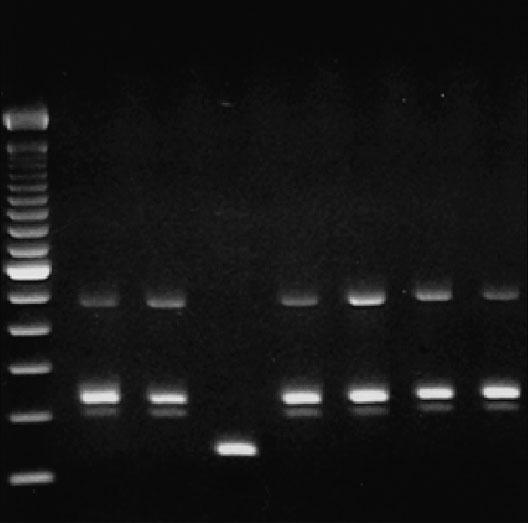 The DNA sequencing was performed as described previously (26).