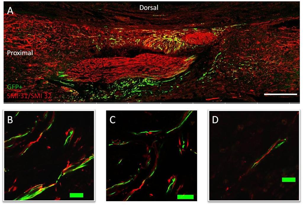Figure 4: Preliminary Evidence of DRG Nerve Construct Integration with Host Axons. (A) GFP_ TENG (green) at 10 days post-transplantation. SMI 31/32 (red) identifies both thick and thin axons.