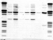Nucleic acids were prepared from blood or cultured human K56 cells according to Protocol Va above, and 50 ng of each preparation were amplified by Expand Long Template PCR.