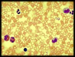 shape Hemoglobin Heme - contains iron and binds