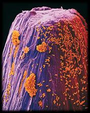 Immune system Body must resist disease in order to