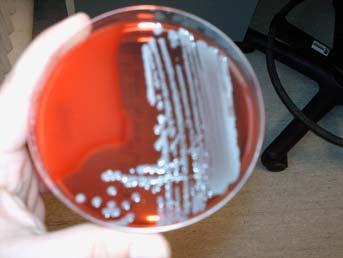 isolationt Check for blue colonies on the chromogenic plate and for typical hemolytic colonies on the blood agar.