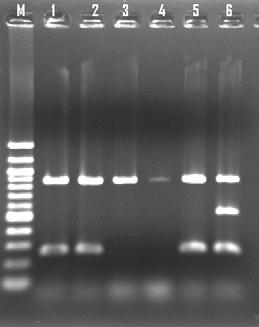 Confirmation of Extract DNA of the suspected isolates Confirm the meca gene presence by PCR (multiplex is the recommended) 16S- confirm the PCR works meca Confirm methicillin resistance Nuc- confirm
