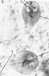 Pathogenic Parasites Feces Associated