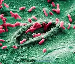 Parasites Intestinal worms or microscopic protozoa that
