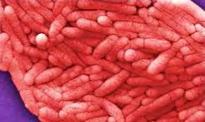 Microbial Causes of Illness Three most common microbes Salmonella E.