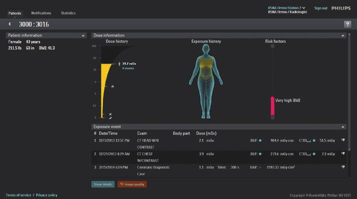 Intuitive data analysis DoseWise Portal provides advanced analytic tools such as customizable dashboards and drill-downs for multivendor/multi-modality imaging systems.
