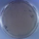 colonies dense bacterial