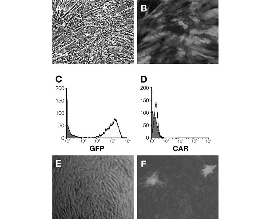1324 AdV Transduction and CAR Expression in hmscs Figure 1. The hmsc culture after infection with Ad-PGK-EGFP adenoviral vectors. (A): Phase microscopic appearance of hmscs.