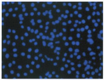 A) T 24 cell line: specific sirna X control sirna untransfected B) 02 0,0400 T24 0,0350 0,0300 Slope (1/hr) 0,0250 0,0200 0,0150 01 0,0100 0,0050 0,0000 A1A2 B1B2 Well (01:04:20-05:04:22) C1C2 00 0.