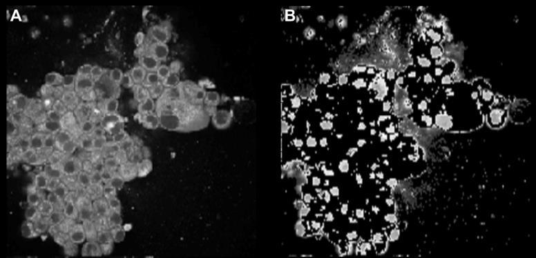 The original image is an NADH fluorescence image, characterized by bright cytoplasms and dark nuclei and background. Figure 2 shows the rescaled image (Fig.