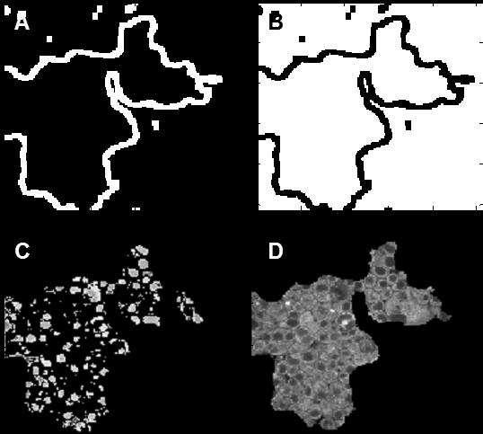 Figure 4. A. Edge detect to identify the edges of the cell clumps or regions of interest. B. Zeros (black) and ones (white) edges mask. C.