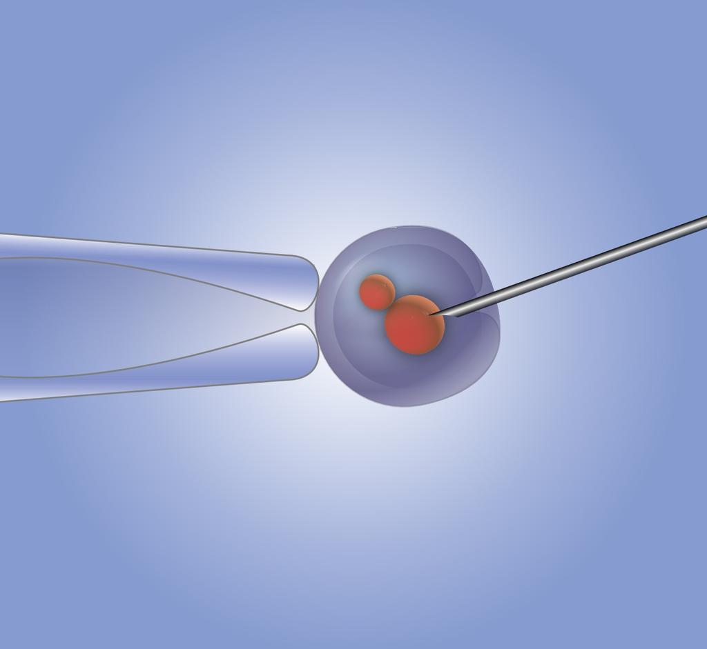 Microinjection method promoter Image modified from KDS444 GOI ORF polya In vitro fertilization Injection of purified, linear DNA into male pronucleus Implantation into pseudopregnant