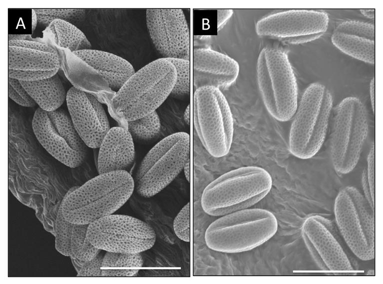 48 49 50 51 52 53 54 55 56 Figure S5. Scanning electron micrographs of pollen derived from upex1/upex1 and irx9l IRX9L plants.