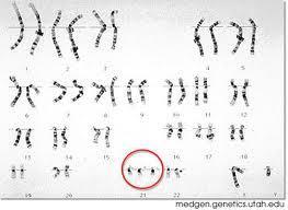 Changes in # or struct of chromosomes May change