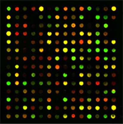 DUAL-CHANNEL DETECTION cdna prepared two samples to be compared (e.g. Diseased tissue versus healthy tissue) labeled with two different fluorophores.